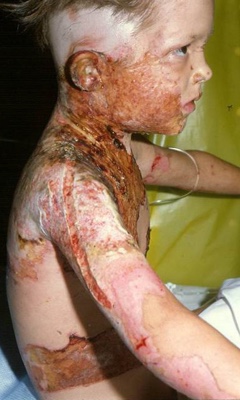 Shay's upper body after the accident